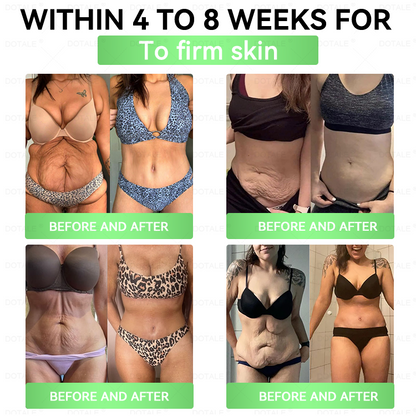 𝑫𝑶𝑻𝑨𝑳𝑬® 𝑺𝒍𝒊𝒎 & 𝑭𝒊𝒓𝒎 𝑵𝒂𝒏𝒐 𝑴𝒊𝒄𝒓𝒐𝒏𝒆𝒆𝒅𝒍𝒆 𝑷𝒂𝒕𝒄𝒉🎁 𝒘𝒊𝒕𝒉 𝑮𝑯𝑲-𝑪𝒖 𝑷𝒆𝒑𝒕𝒊𝒅𝒆 · 𝑩𝒆𝒓𝒃𝒆𝒓𝒊𝒏𝒆 · 𝑴𝒐𝒓𝒊𝒏𝒈𝒂 · 𝑵𝑨𝑫⁺ 𝑪𝒐𝒎𝒑𝒍𝒆𝒙 𝐅𝐨𝐫 𝐨𝐛𝐞𝐬𝐢𝐭𝐲, 𝗟𝗼𝗼𝘀𝗲 𝘀𝗸𝗶𝗻,𝐝𝐢𝐚𝐛𝐞𝐭𝐞𝐬, 𝐬𝐥𝐞𝐞𝐩 𝐚𝐩𝐧𝐞𝐚, 𝐣𝐨𝐢𝐧𝐭 𝐢𝐬𝐬𝐮𝐞𝐬, 𝐚𝐧𝐝 𝐦𝐨𝐫𝐞